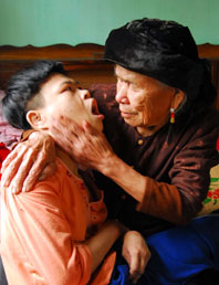 Hãy thể hiện trách nhiệm nhân đạo, cùng Việt Nam khắc phục hậu quả chất độc da cam